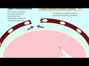 Understanding Pneumothorax in Dogs and Cats