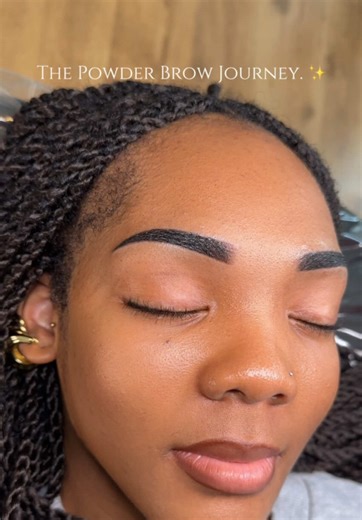 The Powder Brow Lifecycle: From Application to Reveal 🗓️ Managing expectations is the most critical part of any permanent makeup journey. If you are currently in the first 10 days of healing, here is the professional roadmap of your transformation: Days 1–3 (The Peak): Brows appear 20% bolder and significantly darker. This is due to initial swelling and the pigment sitting on the surface of the skin. Days 4–10 (The Transition): The skin begins its natural regenerative process. You may notice li