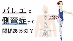 バレエと側弯症って関係あるの？ | バレエダンサーさんの治療院