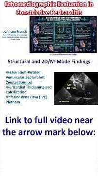 Echocardiographic Evaluation in Constrictive Pericarditis