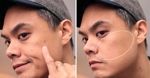 Men: Here's How To Cover Up A Pimple (  How To Treat / Prevent Them)