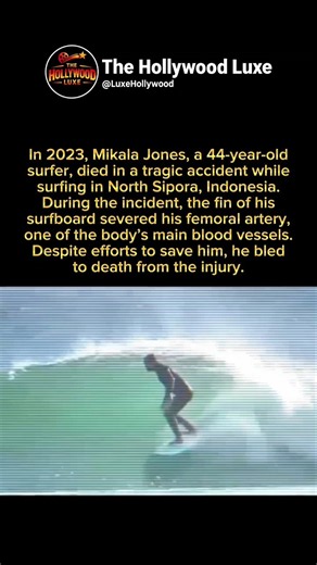 A Surfboard Caused a Fatal Injury