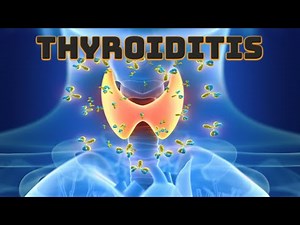 Thyroiditis (updated 2023) - CRASH! Medical Review Series