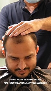 4.5K views · 15 reactions | Today's procedure at Hair Club: FUE Hair...