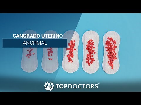 Sangrado uterino anormal (PALM COEIN)