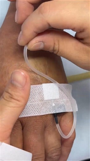 Intramuscular Injection Technique Explained | Safe IM Injection Step-by-Step |Nurse Guide Class N 73