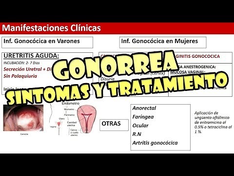 ¿Qué es la gonorrea? Sintomas y Tratamiento para la gonorrea. (EFECTIVO)