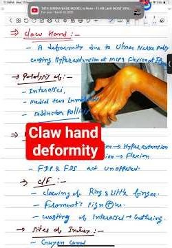 Claw Hand Deformity Explained | Ulnar Nerve Injury | #shorts #anatomy #neet #medicalstudent
