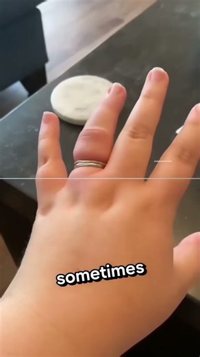 Use this if your ring stuck on your finger