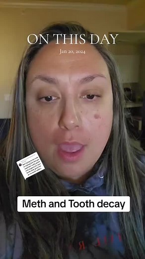 Methamphetamine Addiction and Oral Health: A Personal Journey