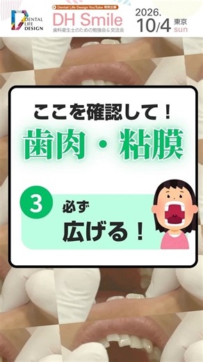 【歯肉、粘膜の確認ポイントについて教えてください(ポイント5～6)】今更聞けない歯科知識 新人歯科衛生士さんのためのお悩み相談室/萬田久美子先生 #shorts