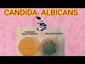 Candida albicans Under the Microscope | Yeast Morphology & Microscopic View