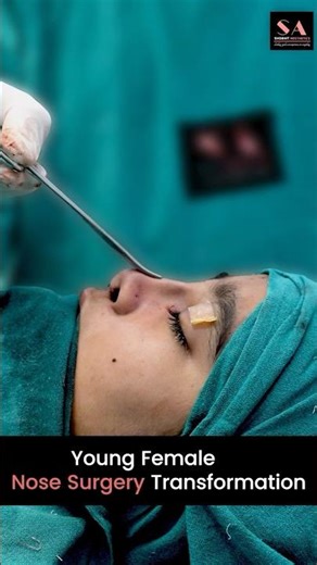 Young Female Nose Surgery Transformation