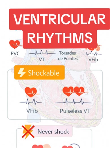 ECG Study: Understanding Shockable vs Non-Shockable Rhythms