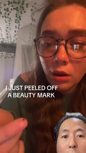 Anthony Youn, MD on Instagram: "She ripped a mole off her face! What would you do? . Video credit: mjs_projects on TT . #plasticsurgeon #moleremoval #skinlesion"