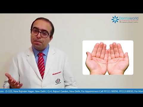 Why Do We Sweat So Much? | Hyperhidrosis