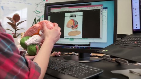 Axis Scientific Kidney Model with Nephrons and Glomerulus - Enlarged Nephrons and Glomerulus - Perfect for Anatomy Students, Urologists, Patient Consultation - Includes Full Color Study Guide