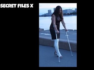 Clip 342 Special moments with long leg cast LLC