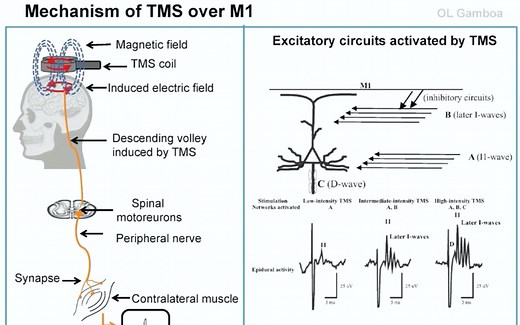 经颅磁刺激_入门_Transcranial Magnetic Stimulation (Session1)