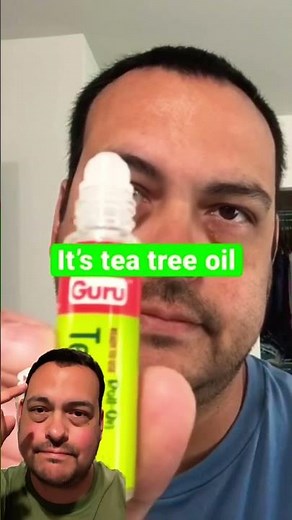 How To Get Rid Of Skin Tags Naturally