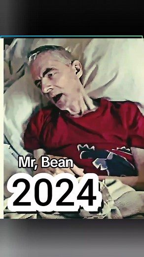 Part 54) Mr, Bean Tv Series Rowan Atkinson - Transformation From 1966 to 2024 Years Old History Usa 🇺🇸 Mrbean #mrbean #mrbeancomedy #old #history #usa #america #uk #newyork #foryou #foryoupage #viral #usa🇺🇸
