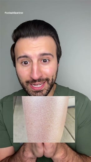 You NEED To Moisturize Daily!!