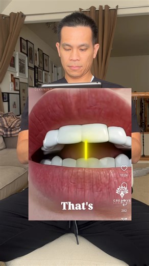 Understanding Open Bite: Causes and Surgical Solutions