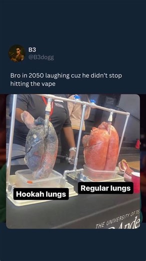 Higher To Health on Instagram: "If you’ve been smoking hookah, backwoods, vapes, or anything in between… your lungs are overdue for a detox 🫁‼️ Your respiratory system works hard for you daily—and toxic buildup from smoke, chemicals, and stress can leave it congested and weak. Time to reset 🌿 Our Lung Detox blend includes powerful herbs to: ✔️ Remove mucus ✔️ Soothe inflammation ✔️ Support clear, healthy breathing Pair it with: 💨 Steam therapy or saunas 🍋‍🟩 Lime shots + hydration 🥗 Clean m