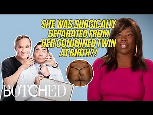 Addie Was A Conjoined Twin At Birth?! (Before & After) | Botched | E!