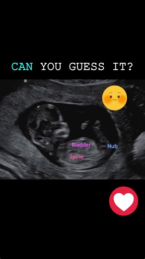 Discover Baby Gender Insights with Nubx App