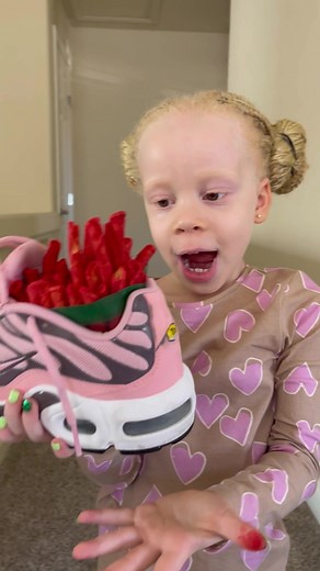 Lyric put TAKIS In My Shoes #tiktok #dcfamily | black yoshi albino kid