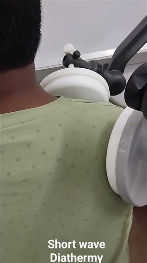 Short Wave Diathermy(SWD) #physiotherapy #physiotherapist #physicaltherapy #pain #painrelief