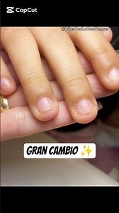 Transformación de uñas con onicofagia ✨