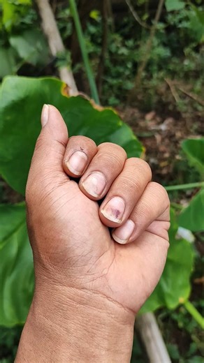 difficult to find it #anyuniqueanimals #insects