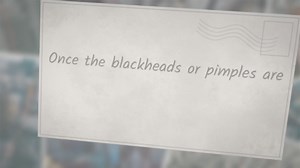 Can Honey Get Rid of Pimples?