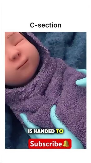 "C-Section Surgery: What Really Happens in the Operating Room"#csectionbirth