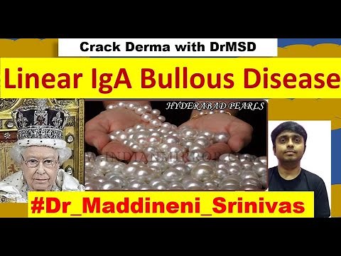 Linear IgA Bullous Disease | Bullous Disease of Childhood | LABD | Crown Cluster of JEWEL | DrMSD |