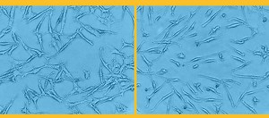 Molecular Gene Switches Linked to Autoimmune Disease | Immunology