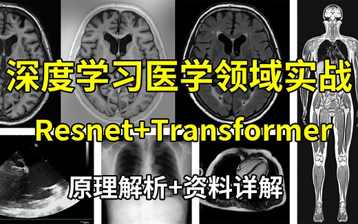 基于深度学习在医学领域实战：Resnet+Transformer！医学分割应用与数据集分类实战！源码解析+原理推导+项目实战！