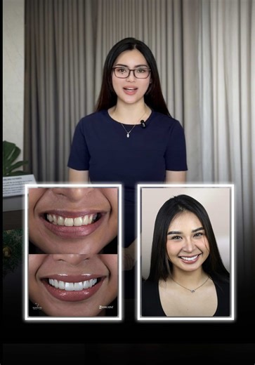 Supreme Smile Transformation with Dr. Camille Yu