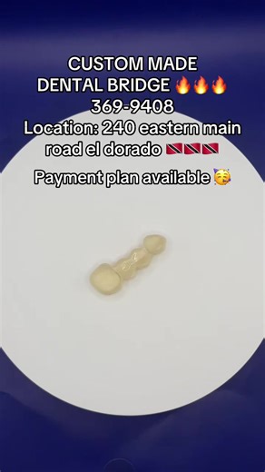 PERMANENT DENTAL BRIDGE #trinidaddentist #dentalbridge #implants #dentures #missingteeth