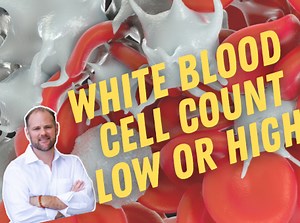 Low White Blood Cell Count and Autoimmune Disease