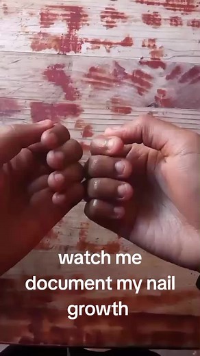 healthynailquest on TikTok