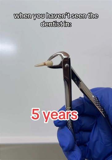 ¿Cuál es tu nivel de visitas al dentista?