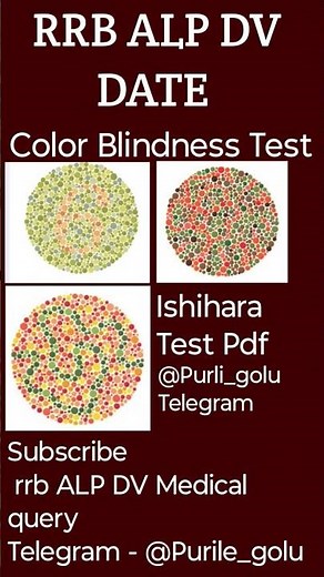 RRB ALP DV Medical Test | Color Blindness Test Explained 🔴🟢 | Ishihara Chart Practice