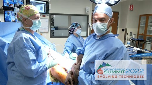 FX V135® Reverse Configuration Live Surgery Performed by Howard W. Harris, MD