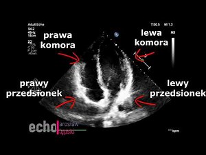 Budowa serca w echokardiografii USG Serca, Kardiolog, Echocardiography Heart