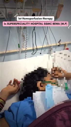 hemoperfusion in rewa #relatable #medico #ssmc