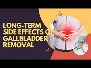 Long-Term Side Effects of Gallbladder Removal