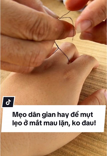 Mẹo dân gian xử lý mụt lẹo ở mắt hiệu quả